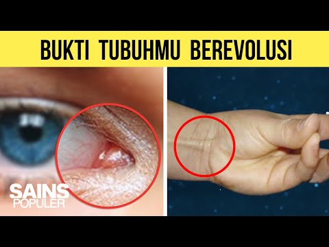 Video: Evolusi Terbalik? Kerangka Manusia Kembali Ke Tulang, Yang Dianggap Sudah Lama Punah - Pandangan Alternatif