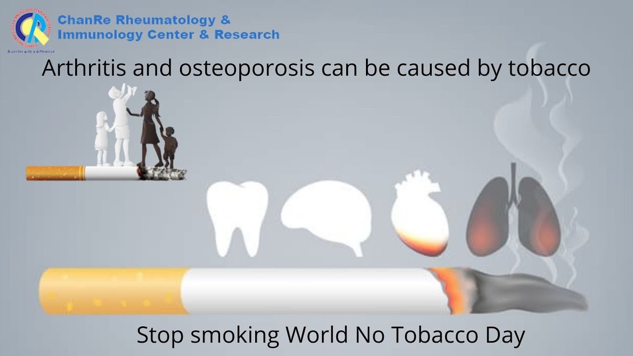 cigarette smoking and osteoporosis Arthritis and osteoporosis can be caused by tobacco