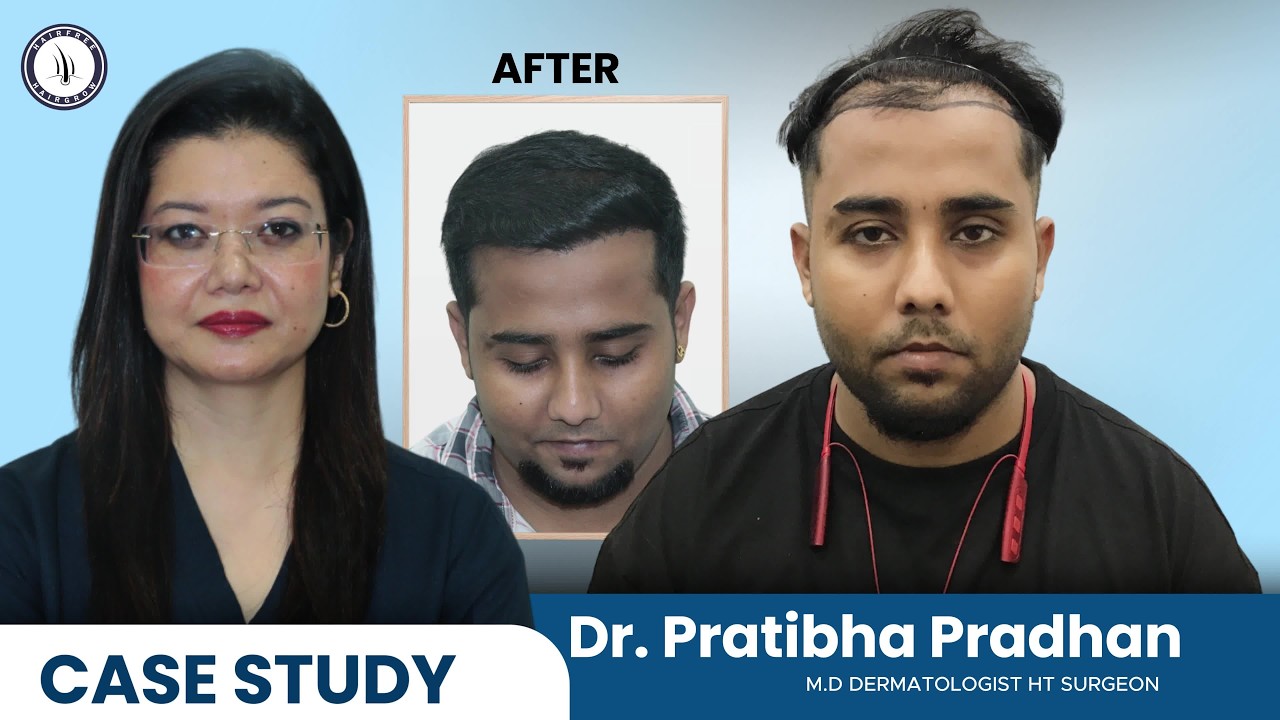 Hair Transplant in Siliguri | Cost of Hair Transplant And Hair Transplant Doctor in Siliguri