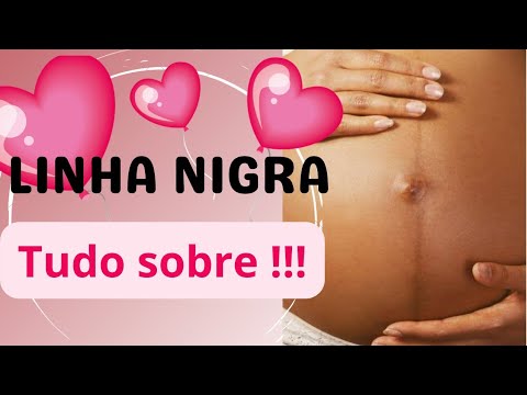 LINHA NIGRA, O QUE É ? Porque eu não tenho ?! - YouTube