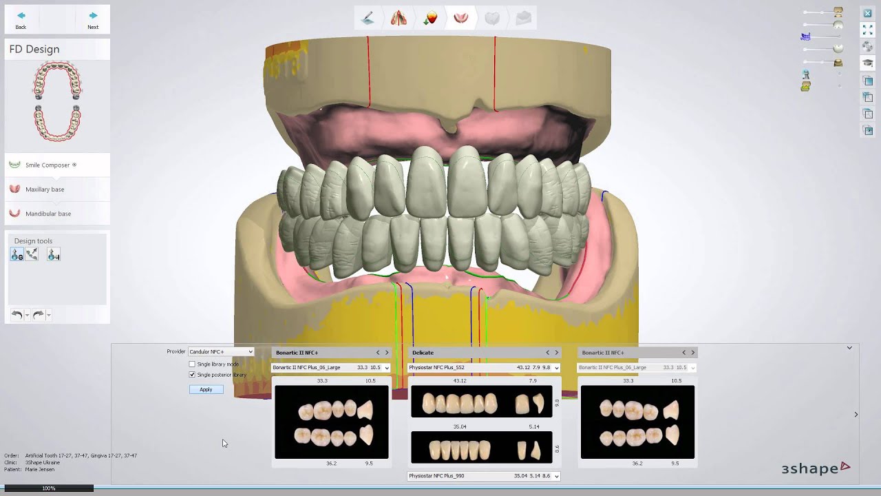 3shape training videos