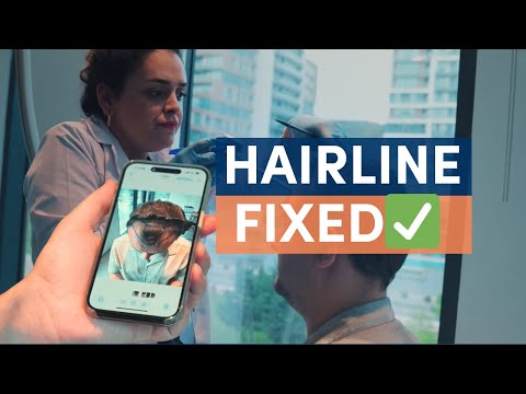 Woke Up with a New Hairline 👀 | Sleep Deep Transplant