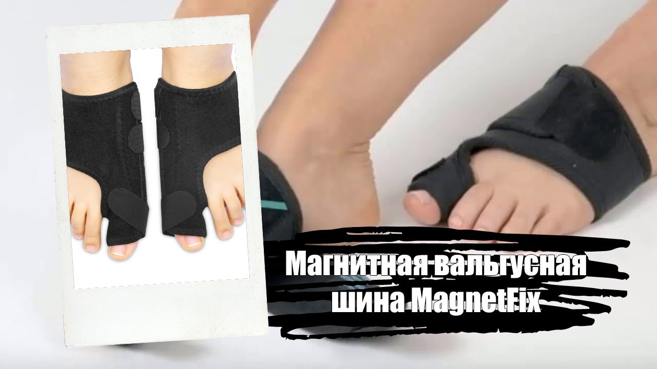 🤧 ВАЛЬГУССТОП ФОТО 😷 - YouTube