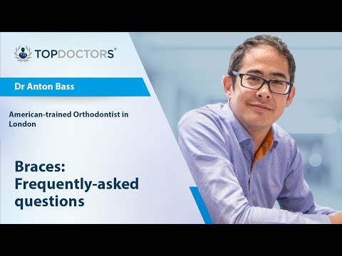 Braces: Frequently-asked questions - Online interview