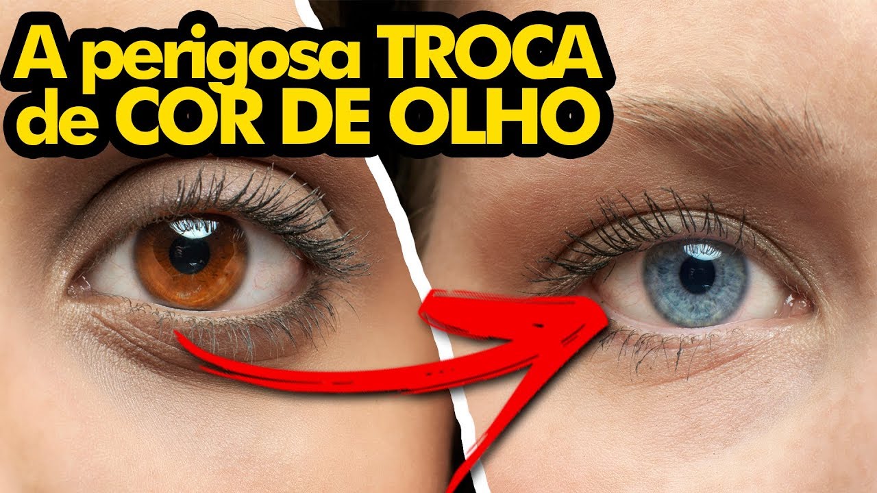 5 cirurgias mais EXTREMAS que as pessoas JÁ FIZERAM