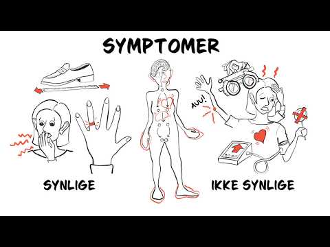 Video: Akromegali - Symptomer, årsaker, Diagnose, Behandlingsmetoder