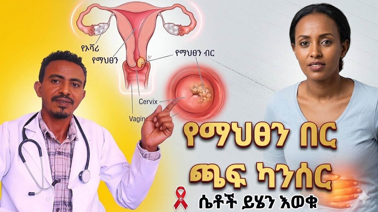 የማህፀን በር ጫፍ ካንሰር እና ህክምናው/Cervical cancer#ጤና#health #education #doctor