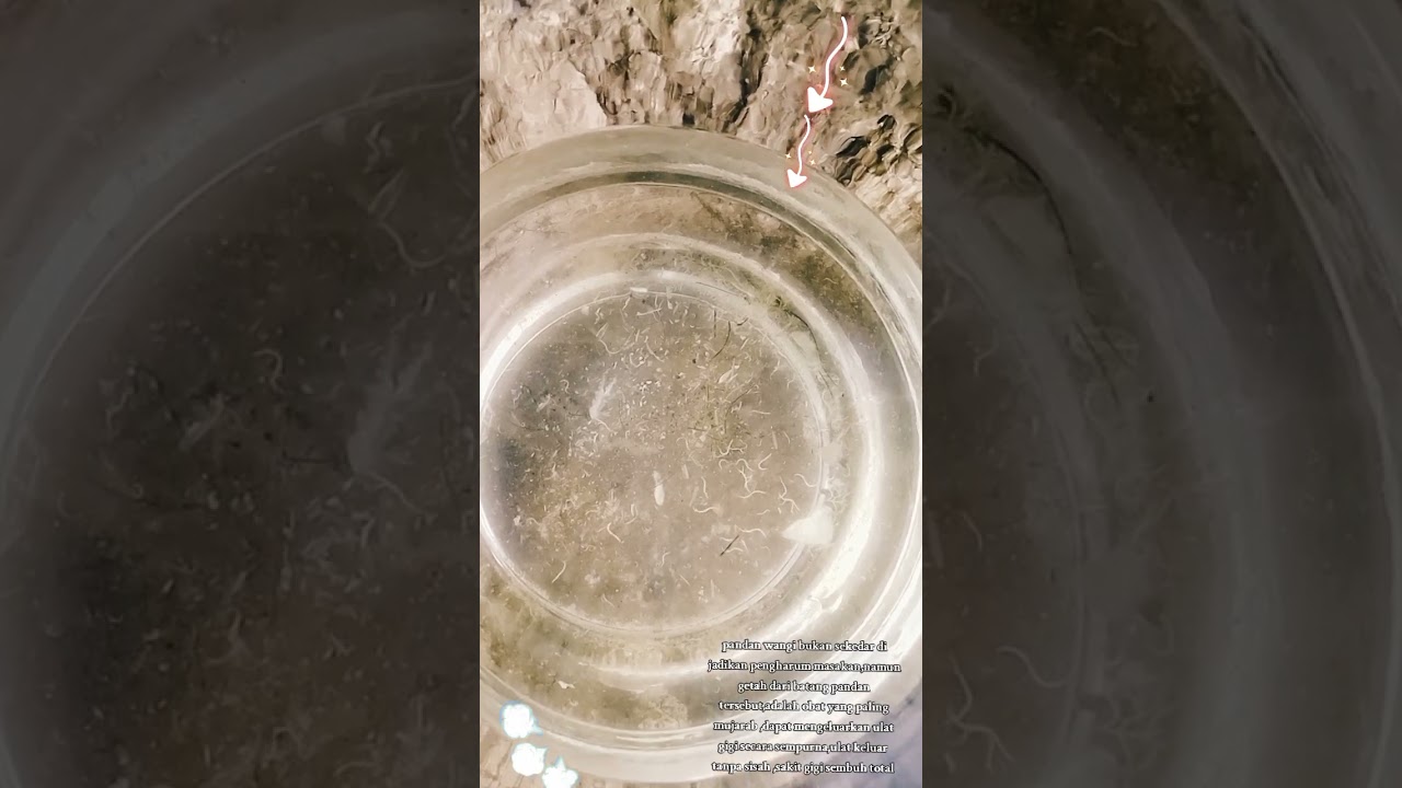 Tutorial mengeluarkan ulat gigi ,dgn getah batang pandan wangi.ulat di tarik habis,gigi sembuh total