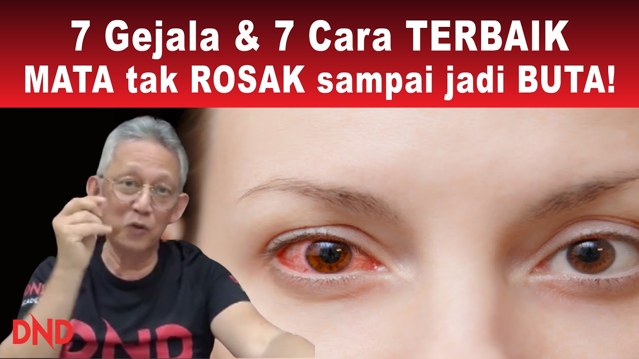 7 Gejala & 7 Cara TERBAIK supaya MATA tak ROSAK sampai jadi BUTA!