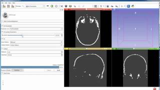 3D Slicer MatlabBridge basics
