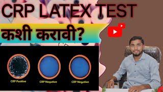 CRP TEST LATEX | kase karave CRP  | CRP kaise karte hai Marathi | CRP TEST mahiti