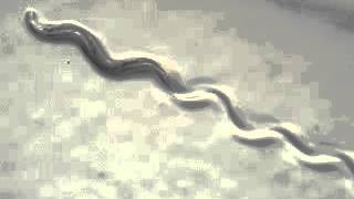 C. elegans wild type (線虫:野生型)