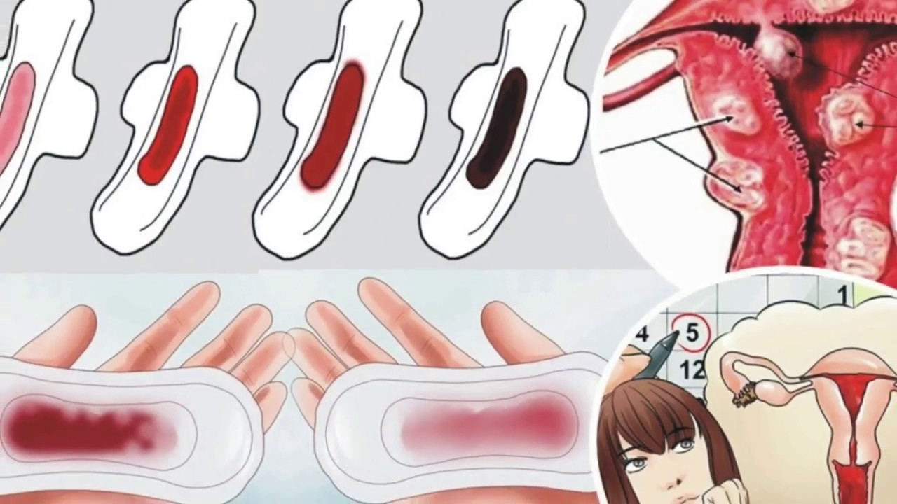 The Color Of The BLOOD Of YOUR PERIOD Reveals Something VERY IMPORTANT