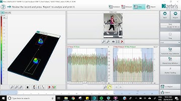 Zebris software example