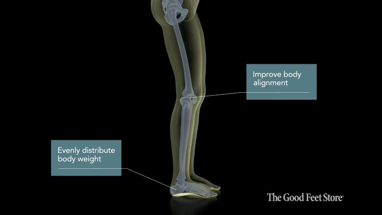 Foot Pain Visalia Good Feet for Foot Pain Plantar Fasciitis Heel Pain