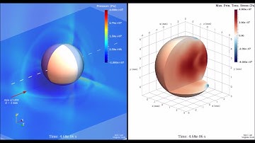 Shock Wave Lithotripsy: 3D Multiphysics Simulation