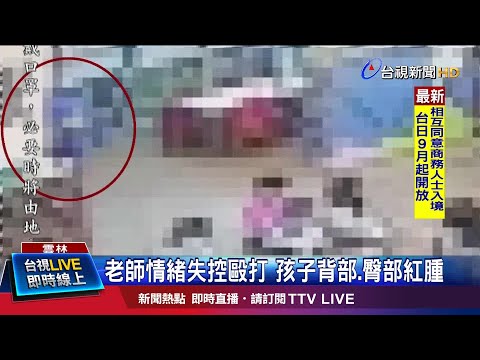 老師情緒失控毆打 孩子背部.臀部紅腫