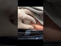 Just hanging out popping blackheads!