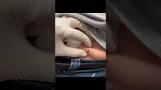 Just hanging out popping blackheads!
