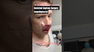 Deviated Septum Surgery sepsioplasty - 111 days Left until we move to Vietnam
