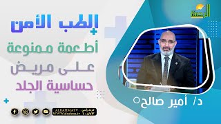 أطعمة ممنوعة على مريض حساسية الجلد || د: أمير صالح