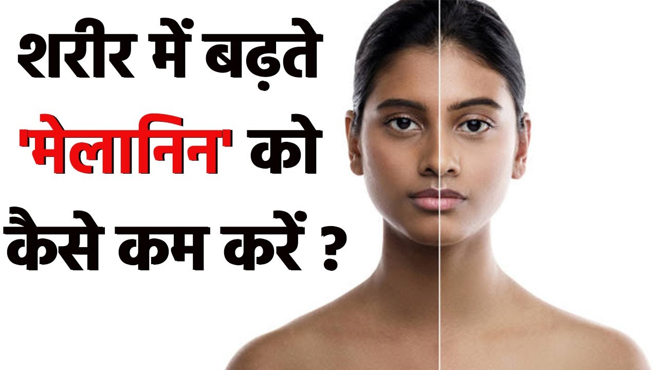 शरीर में मेलानिन की मात्रा कैसे कम करें, Skin Glow का जबरदस्त इलाज Watch Video | Boldsky