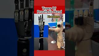 Bionic Hands Live Demo #bornlife #bionichand #hand #foryou #artificiallimb #shortvideo #ytshorts #yt