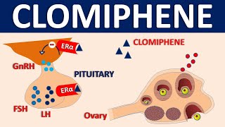 Clomiphene (Clomid) - Mechanism, side effects, precautions & uses