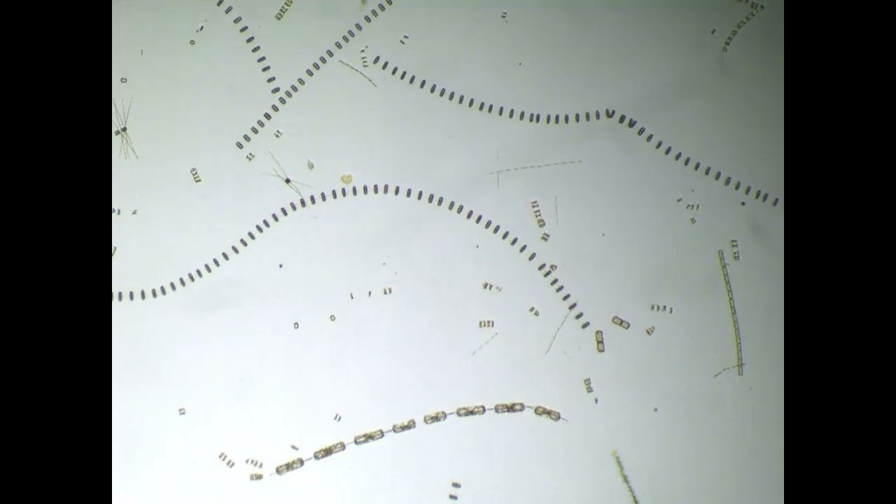 Diatoms multiplying under the microscope