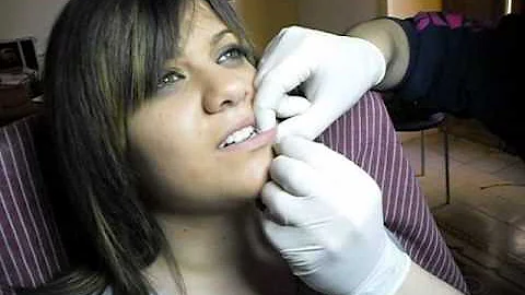Come disinfettare piercing bocca?