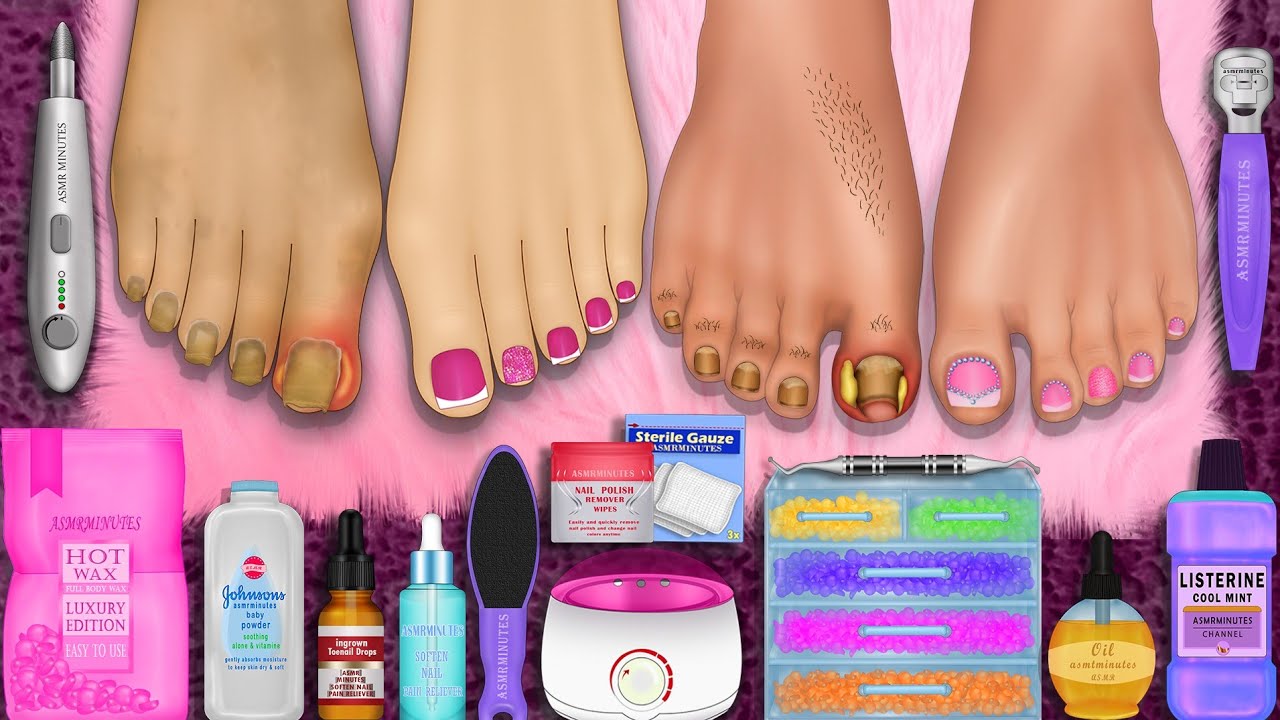 ASMR 🎧 Foot Care Animation 😍 Ingrown toenail , Waxing & Nail Art & Deep clean✨ (collection)