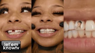 Blueface Finally Got His Girl Chrisean Rock To Fix Her Missing Tooth & This Is What She Did