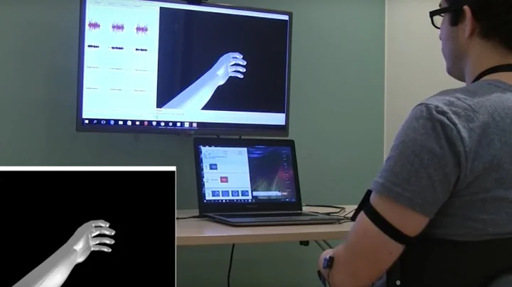 Virtual Reality Brings Pain Relief to Amputees