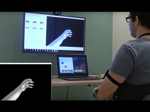 Virtual Reality Brings Pain Relief to Amputees