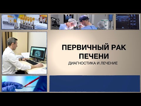 Видео: Почему возникает гепатоцеллюлярная карцинома?