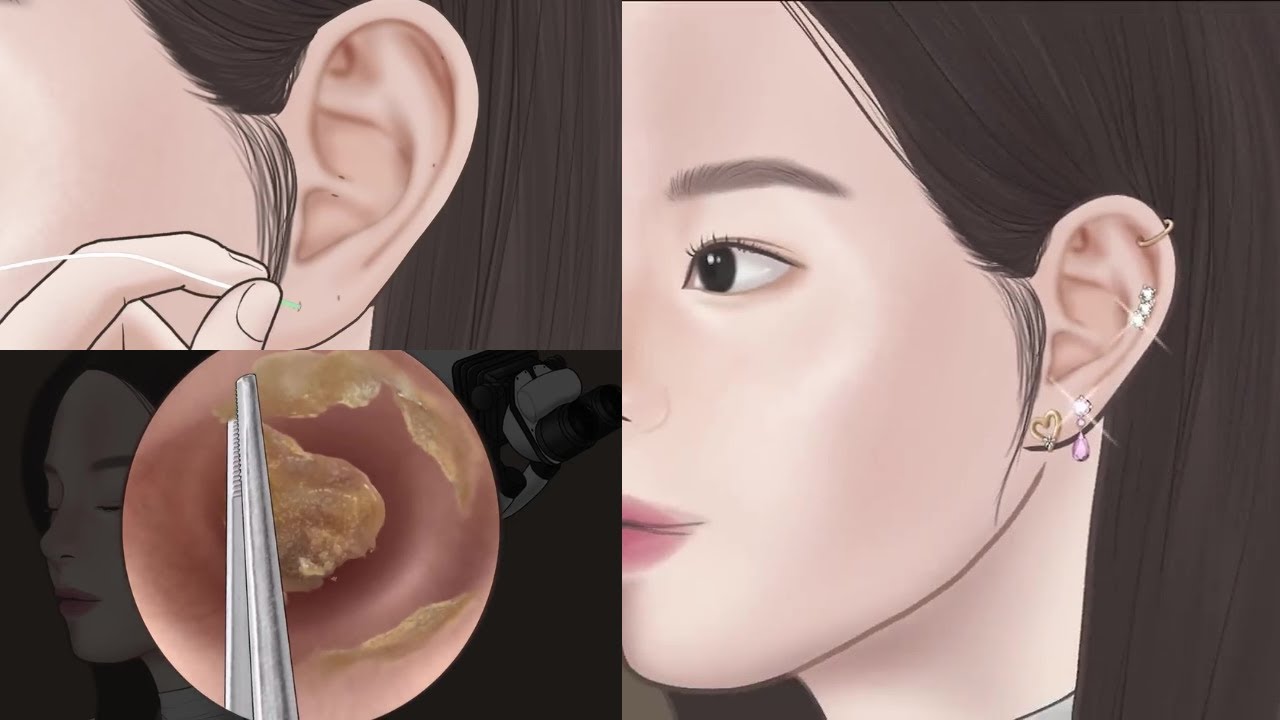 ASMR Animation | Ear Wax Removal and Ear piercing Cleaning. # ...