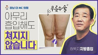 [강남더 MC] 허벅지 지방흡입 하는데 왠 &#39;무릎&#39;? 아이돌 11자 다리 가질 수 있습니다!