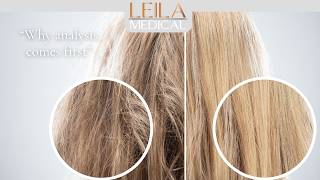 Why Advanced Hair Analysis Changes Everything | Leila Hair Health