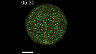 Patiria miniata wild type embryo