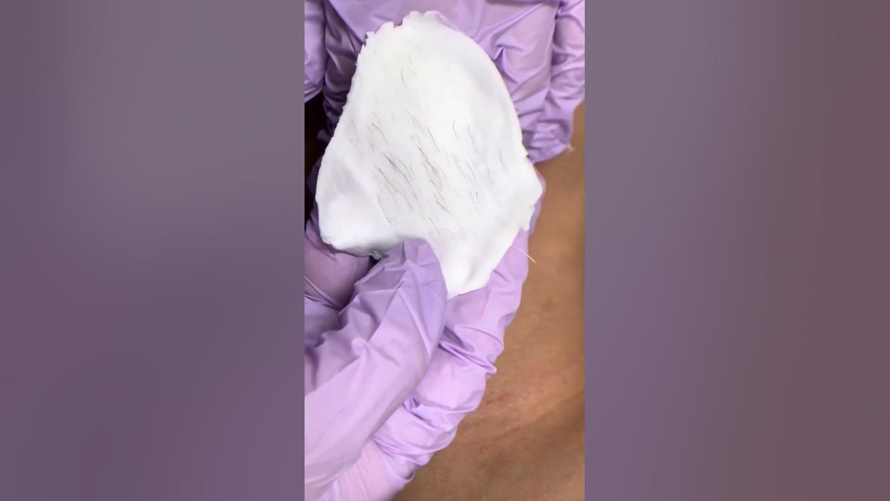 pcos waxing wax chinwax oddlysatisfying YouTube