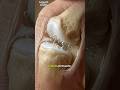 How cracking sound occurs in your joints #facts #viral #science #ytshorts #shorts #education