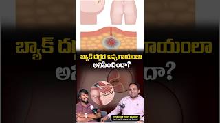 Pilonidal Sinus | Health Tips in Telugu | #healthpodcast #healthtips #HealthAwareness #shorts