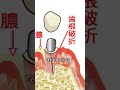 歯が割れる原因とは？歯根破折のリスクと予防法 #歯根破折 #歯が割れる