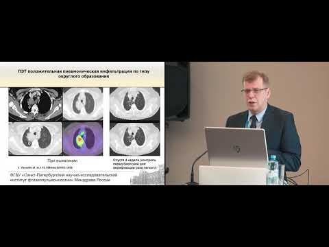 Лучевая диагностика как метод дифференциальной диагностики при патологии легких