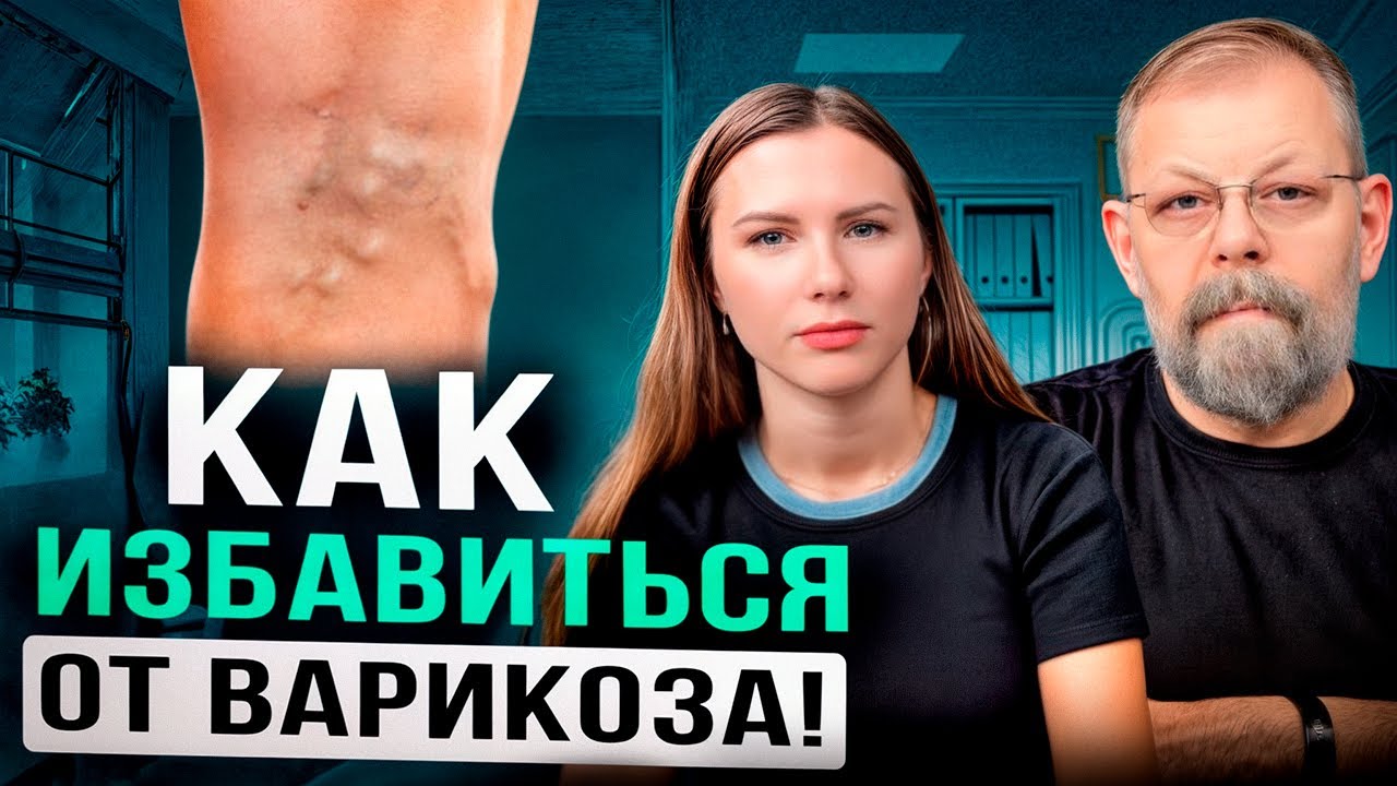 Варикозное расширение вен – Как вылечить варикоз? - YouTube