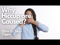 How to stop hiccups | how hiccups are caused simple remedies 🤭