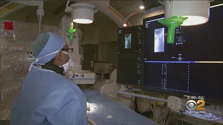 New Procedure Sucks Out Brain Blood Clots