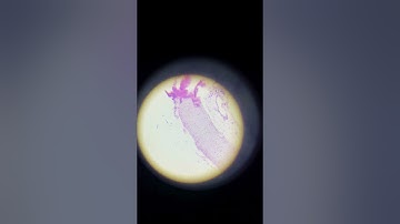 Hyaline cartilage under microscope #microbiology #cellbiology #infectiousdiseases