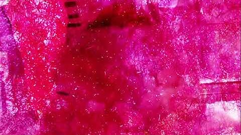 Visualization of Bad Smell