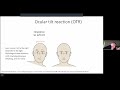 See-saw &amp; Hemi-seesaw Nystagmus - Dr Alexandra Belyakova-Bodina (Moscow) - NES Of India